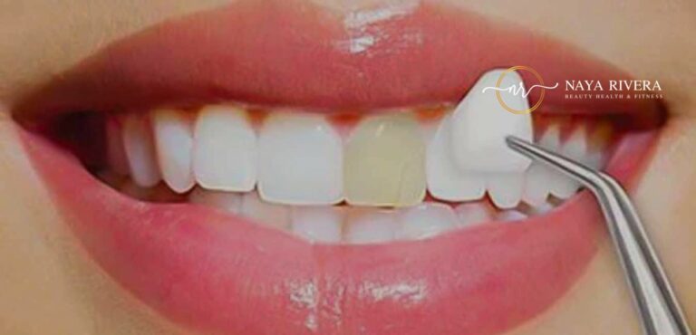 Beyond Aesthetics: The Functional Benefits of Porcelain Veneers Porcelain Veneers