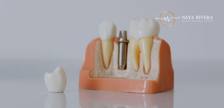 Modern Tooth Replacement